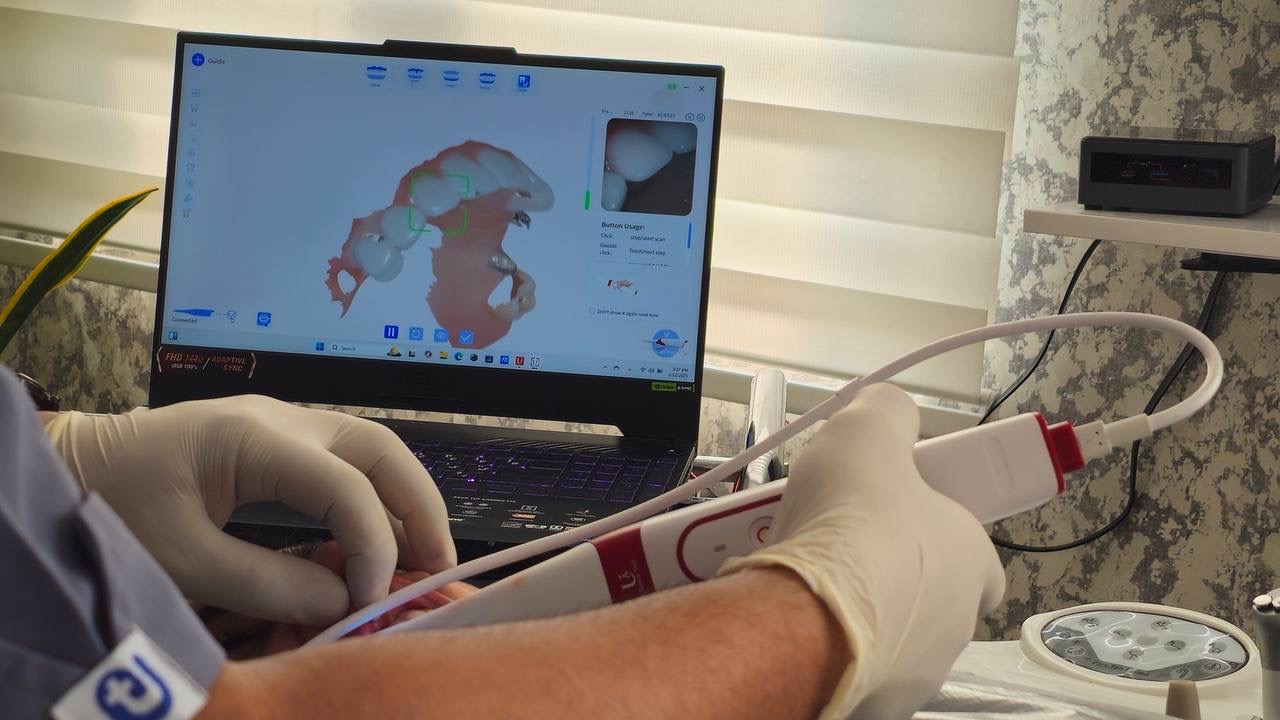 اسکن سه‌بعدی دندان با تکنولوژی دیجیتال