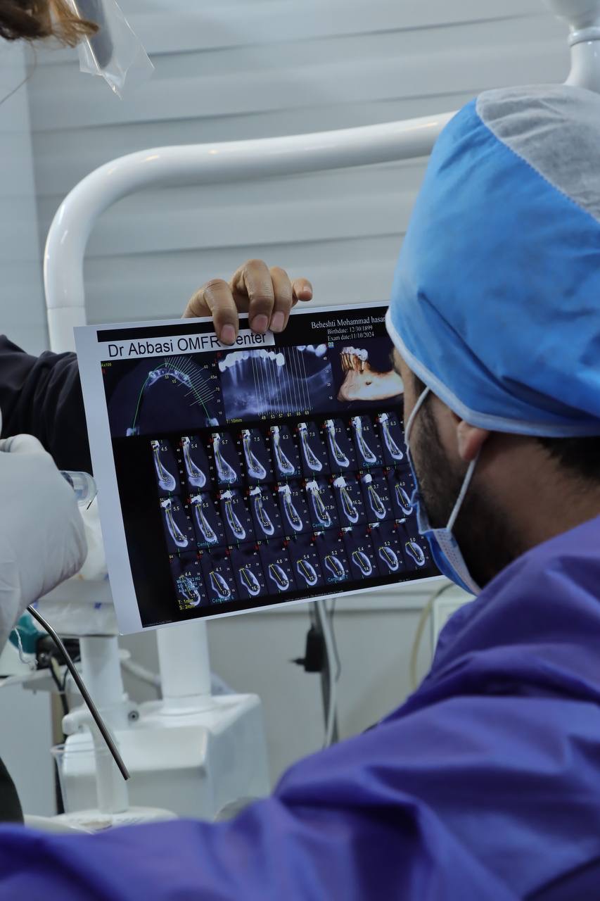 بررسی اسکن CBCT توسط دکتر